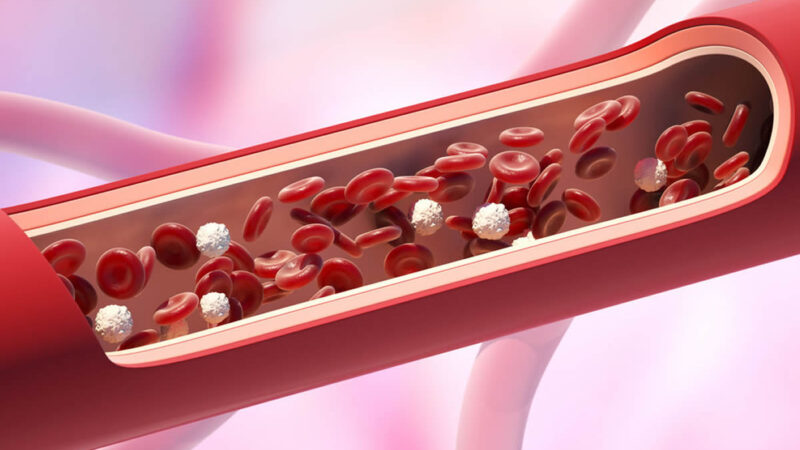 あなたの血管は大丈夫？